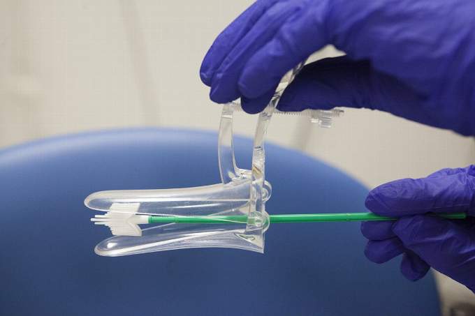 NHS chiefs in Westcountry working to eliminate cervical cancer