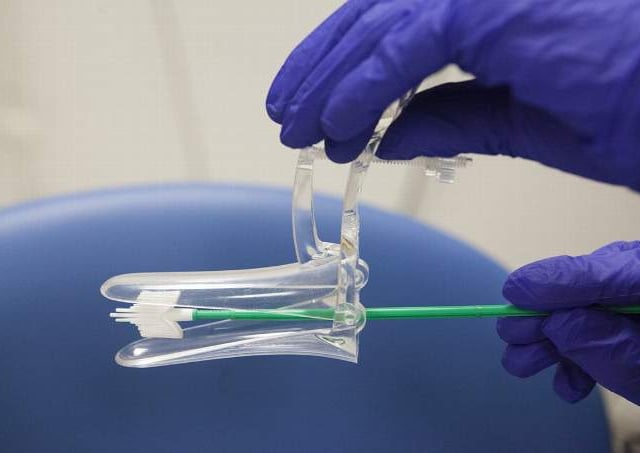 Strategy to prevent cervical cancer