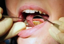Hundreds of admissions for tooth extractions on children in Somerset