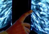 Breast screening uptake in Somerset remains below pre-pandemic levels