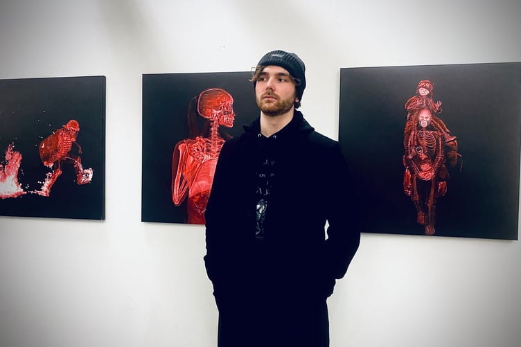 Stephen with numerous pieces of art from his collection 'X-Ray Crises'.