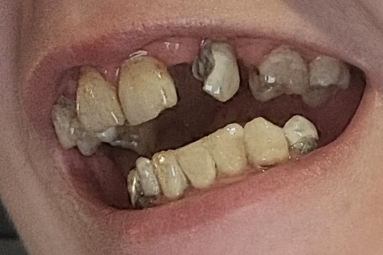 Wellington resident begs local community for support amid ongoing dental health issues