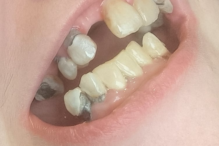 Wellington resident begs local community for support amid ongoing dental health issues