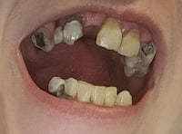 Woman plagued by oral health issues and 'can't smile' begs for help