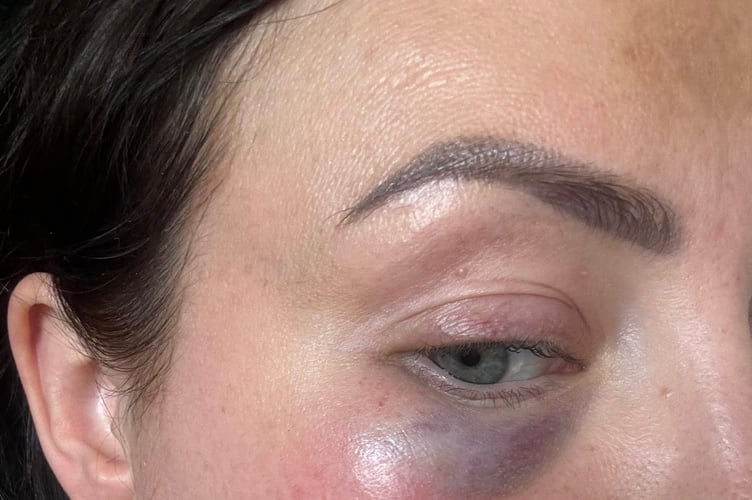 Chantz Crane was attacked outside her barbershop on Fore Street on April 29 in broad daylight