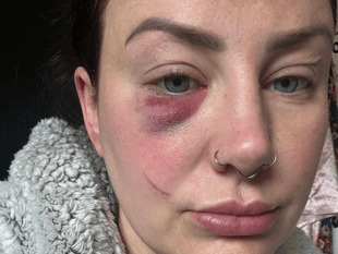 Police appeal after pregnant woman injured in town centre incident