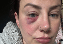 Police appeal after pregnant woman injured in town centre confrontation