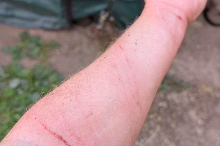 Wildlife enthusiast Lucy was left with lacerations to her arm after rescuing the Muscovy duck.